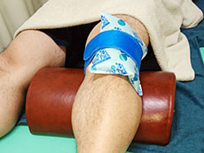 姫路市延末 すずらん接骨院 吸玉（カッピング）療法