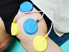 姫路市延末 すずらん接骨院 吸玉（カッピング）療法